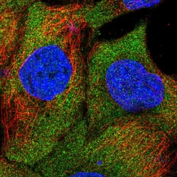 Invitrogen SAMD4B Polyclonal Antibody 100 &mu;L; Unconjugated:Antibodies,