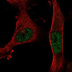Invitrogen BNC2 Polyclonal Antibody 100 &mu;L; Unconjugated:Antibodies,