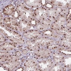 Invitrogen NMNAT1 Polyclonal Antibody 100 &mu;L; Unconjugated:Antibodies,
