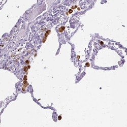 Invitrogen Tartrate Resistant Acid Phosphatase Polyclonal Antibody 100