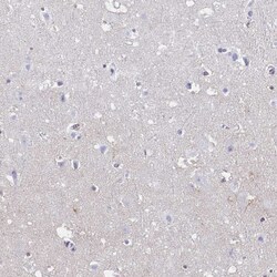 Invitrogen CARD9 Polyclonal Antibody 100 &mu;L; Unconjugated:Antibodies,