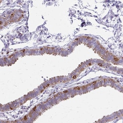 Invitrogen CARD9 Polyclonal Antibody 100 &mu;L; Unconjugated:Antibodies,