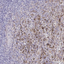 Invitrogen CARD9 Polyclonal Antibody 100 &mu;L; Unconjugated:Antibodies,