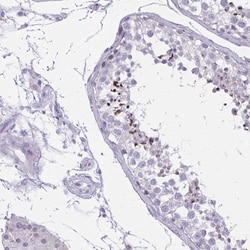 Invitrogen CARD9 Polyclonal Antibody 100 &mu;L; Unconjugated:Antibodies,