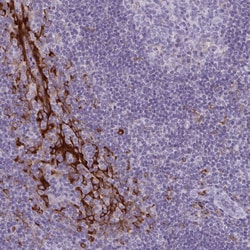 Invitrogen CARD9 Polyclonal Antibody 100 &mu;L; Unconjugated:Antibodies,