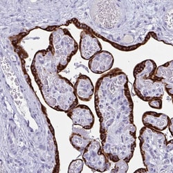 Invitrogen PRDM9 Polyclonal Antibody 100 &mu;L; Unconjugated:Antibodies,