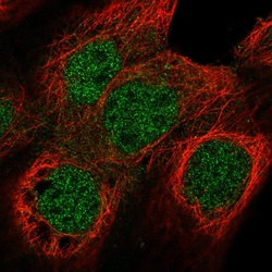 Invitrogen NUF2 Polyclonal Antibody 100 &mu;L; Unconjugated:Antibodies,