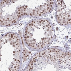 Invitrogen PUF60 Polyclonal Antibody 100 &mu;L; Unconjugated:Antibodies,