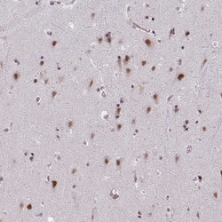 Invitrogen PUF60 Polyclonal Antibody 100 &mu;L; Unconjugated:Antibodies,