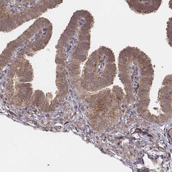 Invitrogen MYO19 Polyclonal Antibody 100 &mu;L; Unconjugated:Antibodies,