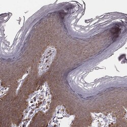 Invitrogen MYO19 Polyclonal Antibody 100 &mu;L; Unconjugated:Antibodies,