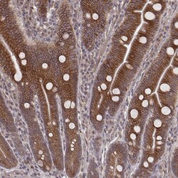 Invitrogen MYO19 Polyclonal Antibody 100 &mu;L; Unconjugated:Antibodies,