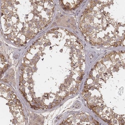 Invitrogen MYO19 Polyclonal Antibody 100 &mu;L; Unconjugated:Antibodies,