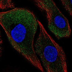 Invitrogen CAPNS2 Polyclonal Antibody 100 &mu;L; Unconjugated:Antibodies,