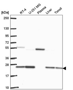 Invitrogen GLO1 Polyclonal Antibody 100 &mu;L; Unconjugated:Antibodies,