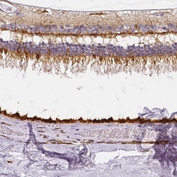 Invitrogen RPGRIP1 Polyclonal Antibody 100 &mu;L; Unconjugated:Antibodies,