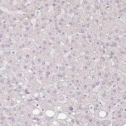 Invitrogen RPGRIP1 Polyclonal Antibody 100 &mu;L; Unconjugated:Antibodies,