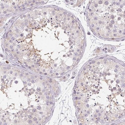 Invitrogen RPGRIP1 Polyclonal Antibody 100 &mu;L; Unconjugated:Antibodies,