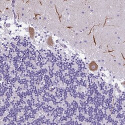 Invitrogen PAK3 Polyclonal Antibody 100 &mu;L; Unconjugated:Antibodies,
