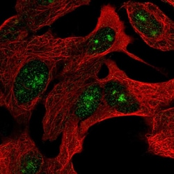 Invitrogen ZNF790 Polyclonal Antibody 100 &mu;L; Unconjugated:Antibodies,
