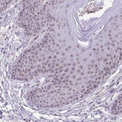 Invitrogen SENP3 Polyclonal Antibody 100 &mu;L; Unconjugated:Antibodies,