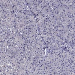 Invitrogen FAM101B Polyclonal Antibody 100 &mu;L | Buy Online | Invitrogen&trade; | Fisher Scientific