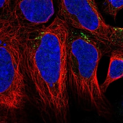 Invitrogen AGPAT4 Polyclonal Antibody 100 &mu;L; Unconjugated:Antibodies,