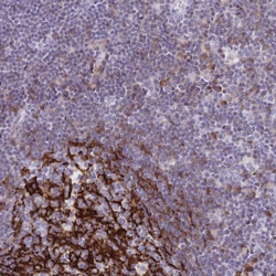 Invitrogen CD21 Polyclonal Antibody 100 &mu;L | Buy Online | Invitrogen&trade; | Fisher Scientific
