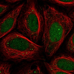 Invitrogen CHD2 Polyclonal Antibody 100 &mu;L; Unconjugated:Antibodies,