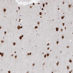 Invitrogen CHD2 Polyclonal Antibody 100 &mu;L; Unconjugated:Antibodies,