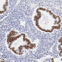 Invitrogen CHD2 Polyclonal Antibody 100 &mu;L; Unconjugated:Antibodies,