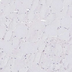 Invitrogen CHD2 Polyclonal Antibody 100 &mu;L; Unconjugated:Antibodies,