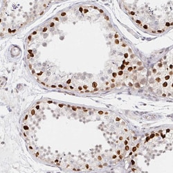 Invitrogen CHD2 Polyclonal Antibody 100 &mu;L; Unconjugated:Antibodies,