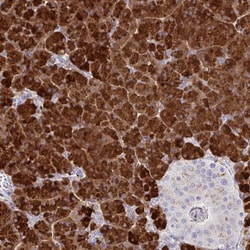 Invitrogen PLA2 Polyclonal Antibody 100 &mu;L; Unconjugated:Antibodies,