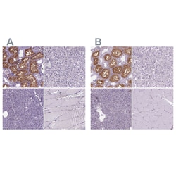 Invitrogen CLIC4 Polyclonal Antibody 100 &mu;L; Unconjugated:Antibodies,