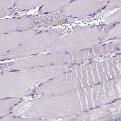 Invitrogen CLIC4 Polyclonal Antibody 100 &mu;L; Unconjugated:Antibodies,