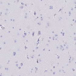 Invitrogen CD5 Polyclonal Antibody 100 &mu;L; Unconjugated:Antibodies,