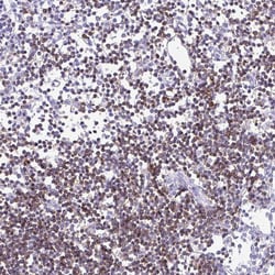 Invitrogen CD5 Polyclonal Antibody 100 &mu;L; Unconjugated:Antibodies,