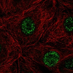 Invitrogen DCAKD Polyclonal Antibody 100 &mu;L; Unconjugated:Antibodies,