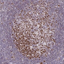 Invitrogen EED Polyclonal Antibody 100 &mu;L; Unconjugated:Anticuerpos