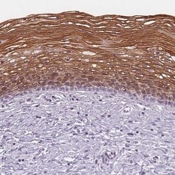 Invitrogen Cytokeratin 6A Polyclonal Antibody 100 &mu;L; Unconjugated:Antibodies,