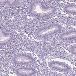 Invitrogen Cytokeratin 6A Polyclonal Antibody 100 &mu;L; Unconjugated:Antibodies,