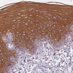 Invitrogen Cytokeratin 6A Polyclonal Antibody 100 &mu;L; Unconjugated:Antibodies,