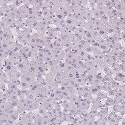 Invitrogen Cytokeratin 6A Polyclonal Antibody 100 &mu;L; Unconjugated:Antibodies,