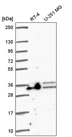 Invitrogen ALY Polyclonal Antibody 100 &mu;L | Buy Online | Invitrogen&trade; | Fisher Scientific