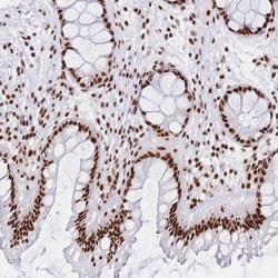 Invitrogen SRSF1 Polyclonal Antibody 100 &mu;L; Unconjugated:Antibodies,