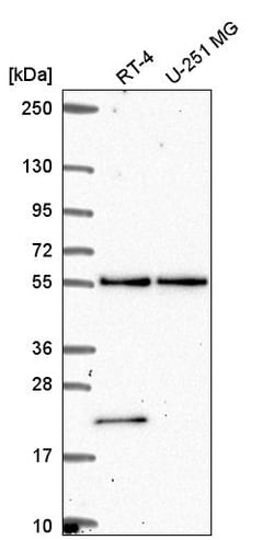 Invitrogen POLR3D Polyclonal Antibody 100 &mu;L; Unconjugated:Antibodies,