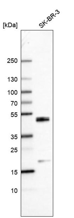 Invitrogen C/EBP beta Polyclonal Antibody 100 &mu;L; Unconjugated:Anticorps,