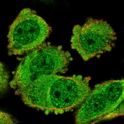Invitrogen TACC2 Polyclonal Antibody 100 &mu;L; Unconjugated:Antibodies,