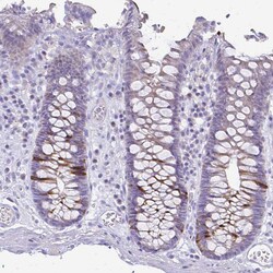 Invitrogen Cyclin B1 Polyclonal Antibody 100 &mu;L; Unconjugated:Antibodies,